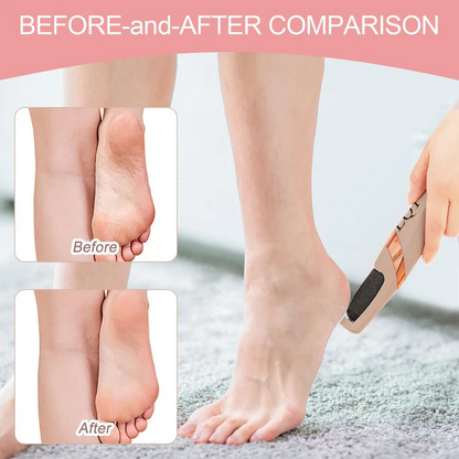 Electric Pedicure Foot File Callus Remover
